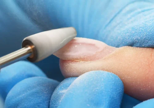 Gel Removal | Jevelme Salon & Spa